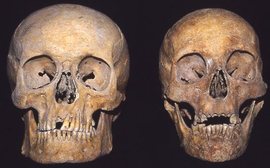 Male and female skulls